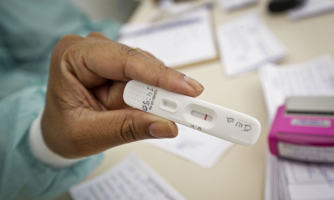 Anvisa faz a liberação de uma nova marca de autoteste para Covid-19