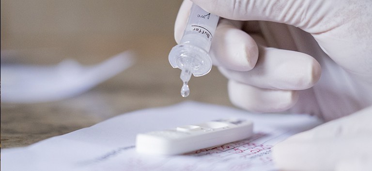 Anvisa recebe 1° pedido de registro de autoteste de Covid