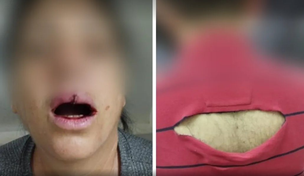 Avos brigam com médico ginecologista após se irritarem com pergunta à neta