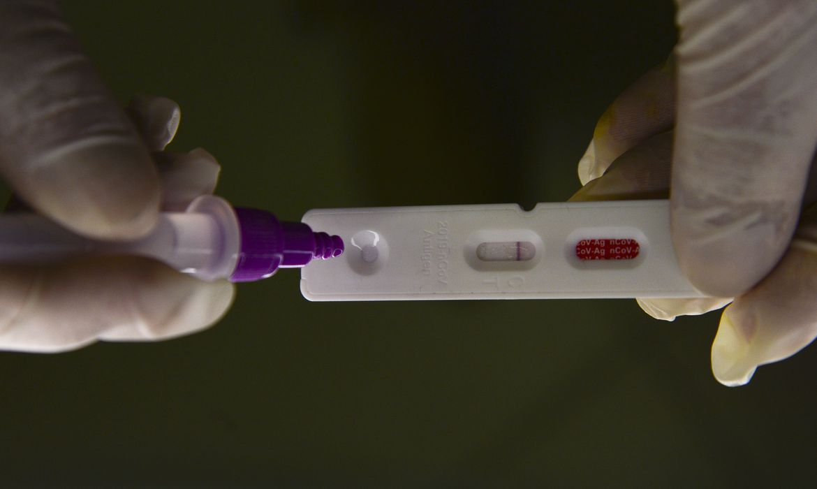 Método capaz de prever gravidade da Covid é identificado por pesquisadores