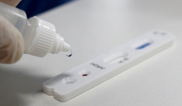 Hospitais estaduais goianos oferecem testes rápidos de Covid-19